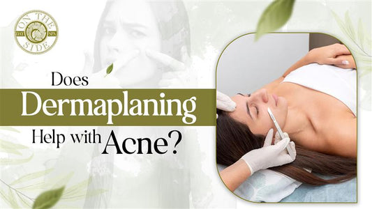 Does Dermaplaning Help with Acne?
