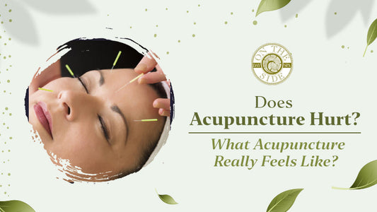 Acupuncture Hurt